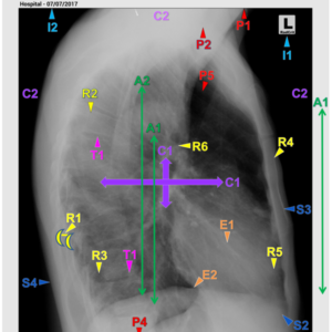 CHEST - LAT (3 CEUs)