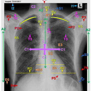 CHEST - PA (3 CEUs)