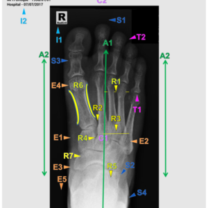 FOOT - AP/OBL/LAT (3 CEUs)