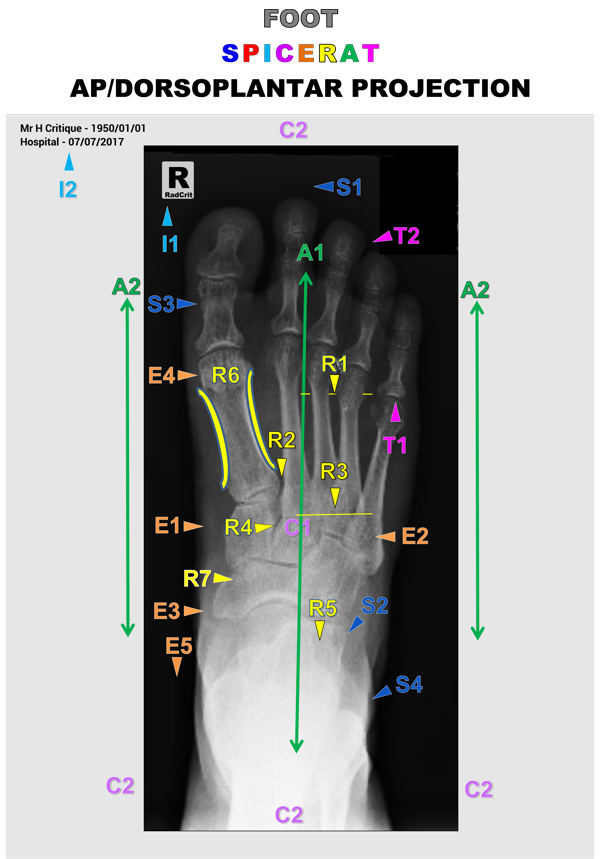 FOOT_AP Full