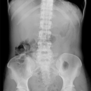 Abdomen
