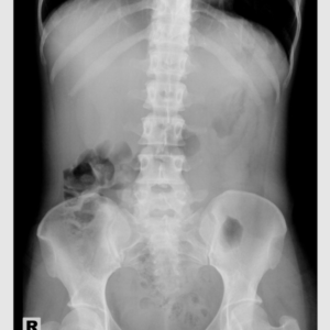 Abdomen