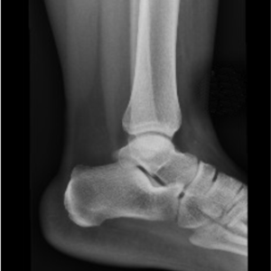 Lower Extremities