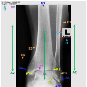 ANKLE - AP/MED OBL/MORT (3 CEUs)