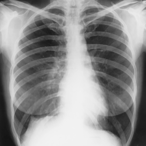 Thorax