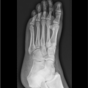 Foot