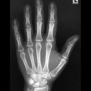 Hand