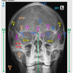 SKULL - PA (3 CEUs)