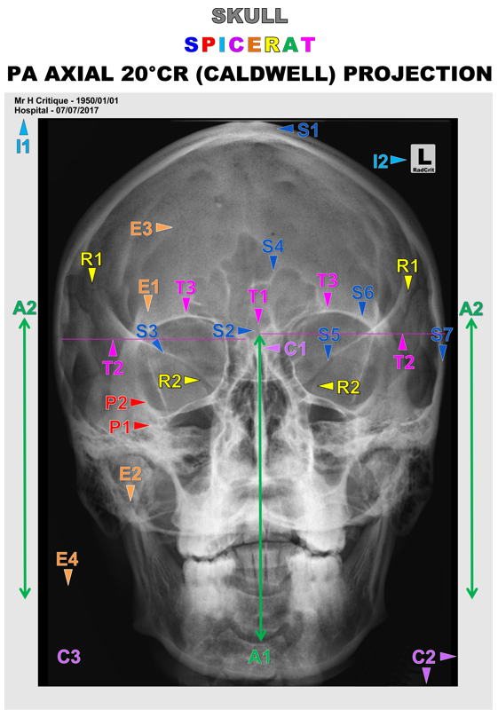 SKULL_PA_CLW 20° Full