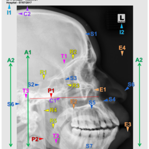SKULL - LATERAL (3 CEUs)