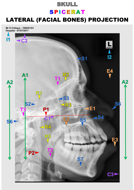 SKULL_LAT_F BNS Full