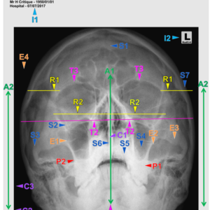 SKULL - WATERS (3 CEUs)