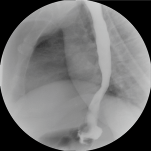 Fluoroscopy