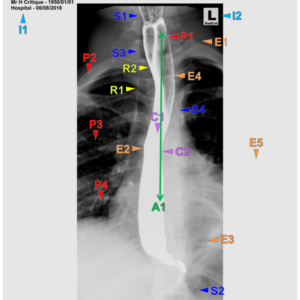 ESOPHAGRAM - AP/OBL/LAT (3 CEUs)