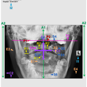C SPINE - OPEN MOUTH/AP DENS (3 CEUs)