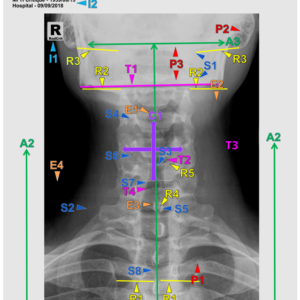 C SPINE - AP AXIAL (3 CEUs)