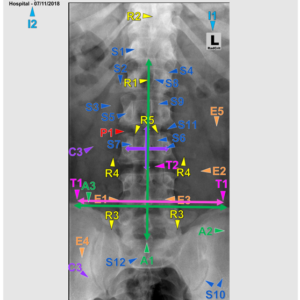L SPINE - AP (3 CEU's)
