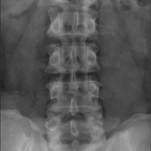 L SPINE