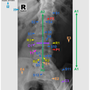 L SPINE  - PA OBLIQUE (3 CEUs)