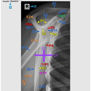 SHOULDER - LATERAL (SCAPULAR Y) (3CEUs) - Image 1