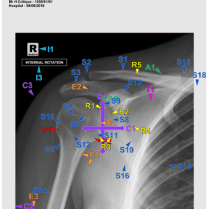 SHOULDER -AP (3 CEUs)
