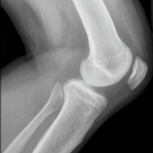 Knee