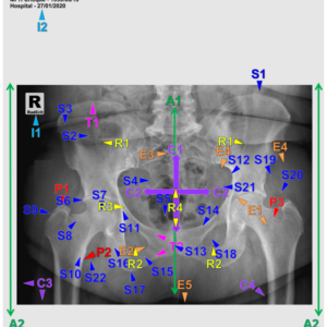HIP AND PELVIS - AP (3 CEUS)