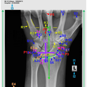 WRIST - PA/MED OBLIQUE (3 CEUs)