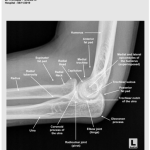 ELBOW - LATERAL - ANATOMY