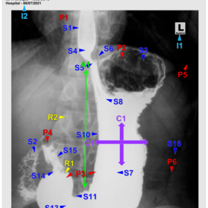 BARIUM MEAL - AP/OBL/LAT (3 CEUs)