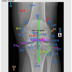 KNEE - AP (3 CEUs)