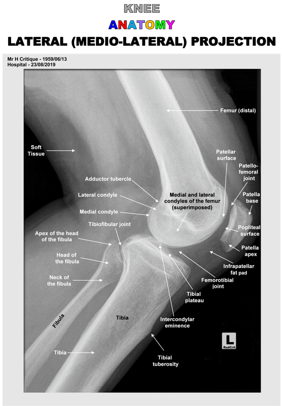 Lateral Knee Anatomy Radiology